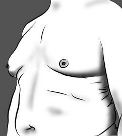 Жирная грудь у мужчин, как избавиться?